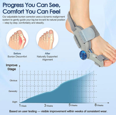 Adjustable Bunion Corrector – Comfortable Hallux Valgus Support